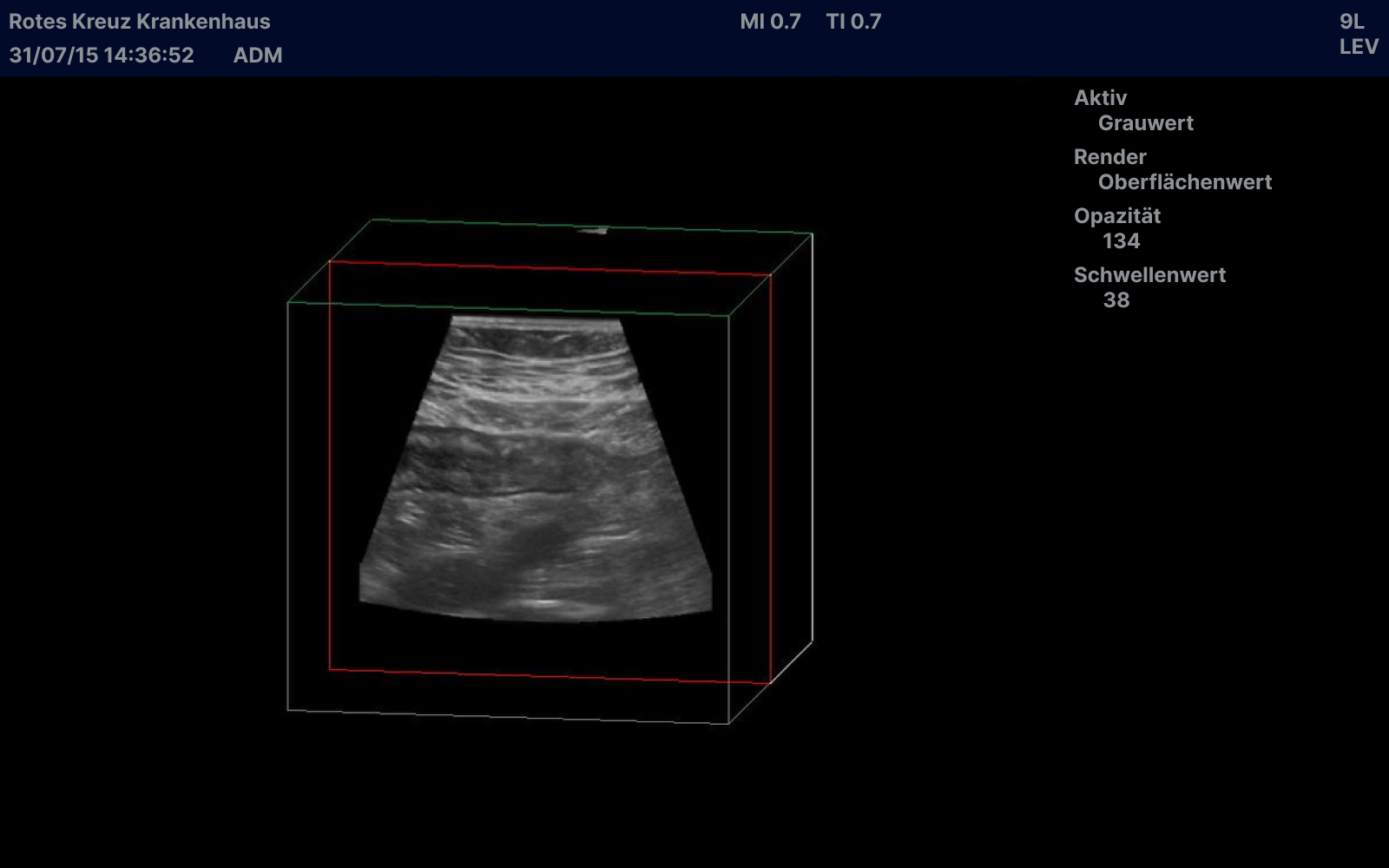 sonography image